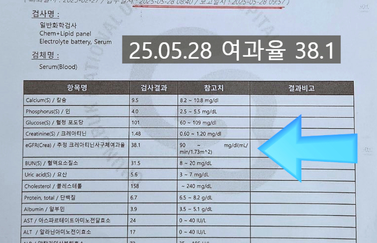 사례02 검사결과 25년 5월